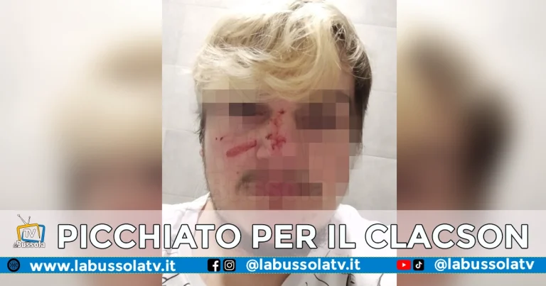 Bacoli: pestato a sangue per aver strombazzato il clacson