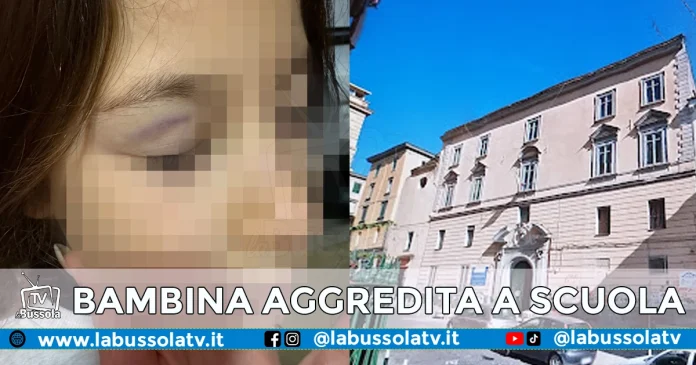 NAPOLI BAMBINA AGGREDITA A SCUOLA